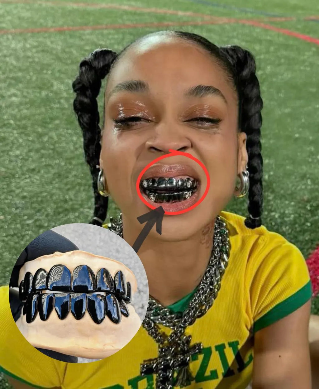 🖤 Black Chrome Grills — Mold Kit Included 🖤